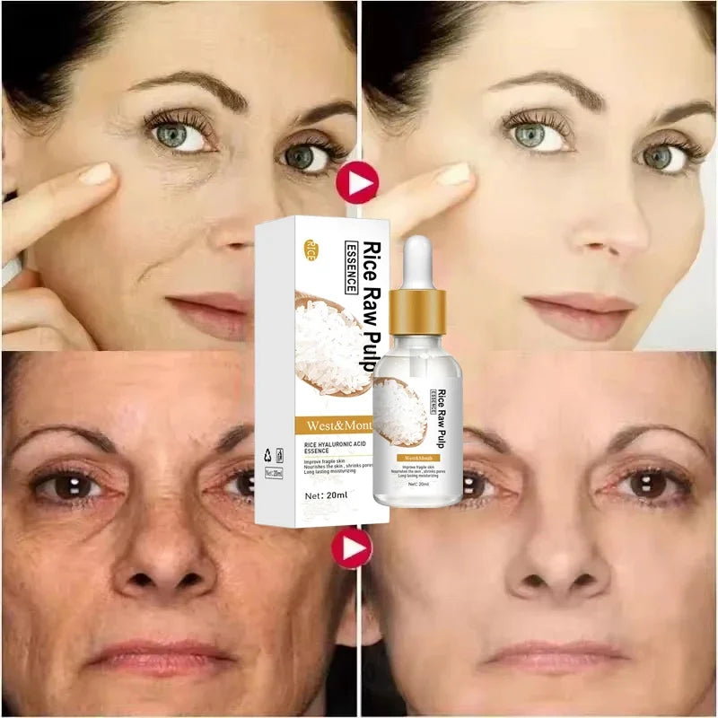 White Rice Whitening Serum Wrinkle Remover Fade Fine Lines Remove Dark Spots Melanin Anti-aging Brighten Smooth Face Skin Care