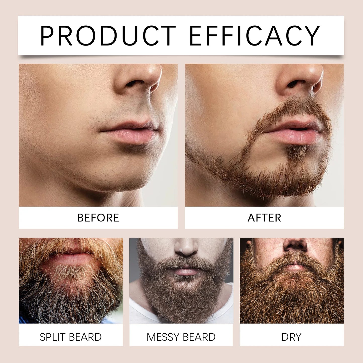 Beard Balm for Men with Sandalwood&Beeswax - Nourishing&Softening Beard Care Balm, Vitamin E Enriched, Anti-Itch Formula for dry