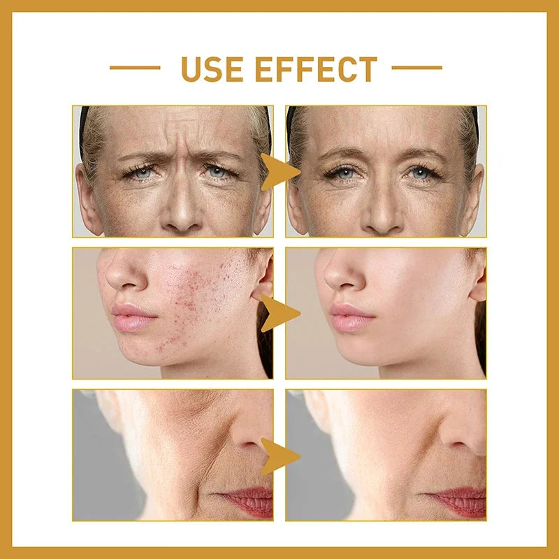 White Rice Whitening Serum Wrinkle Remover Fade Fine Lines Remove Dark Spots Melanin Anti-aging Brighten Smooth Face Skin Care