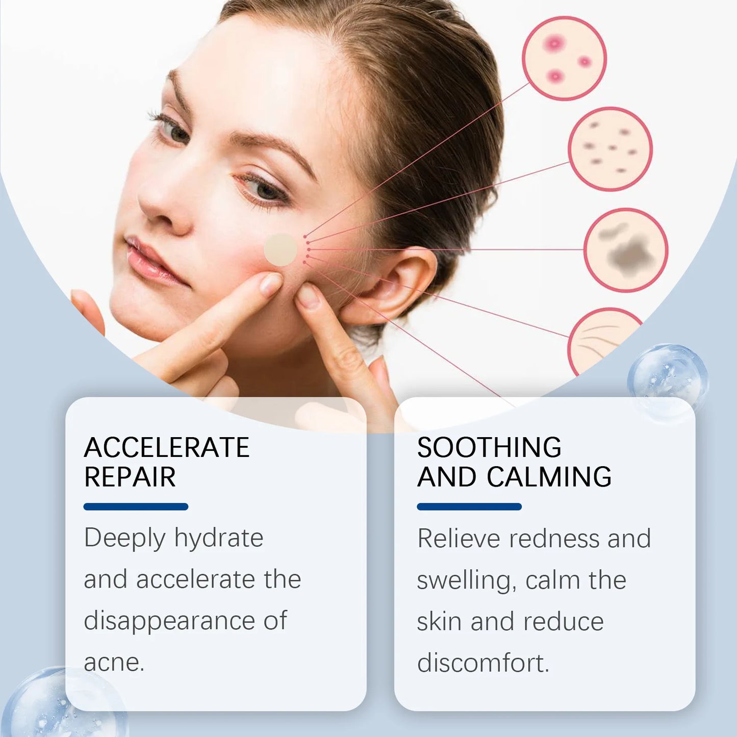 Ouhoe 240pcs Invisible Acne Patches Face Spot Scar Care Pimple Remover Waterproof Acne Healing Concealer Covering Face Stickers