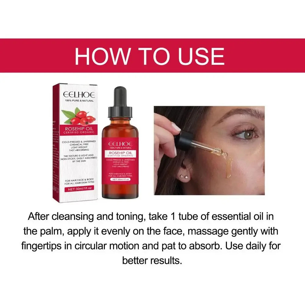 30ml Organic Rosehip Seed Oil For Face Pure Cold Pressed Facial Oil Natural Moisturizing Skin Care Serum For Scars Stretch Marks