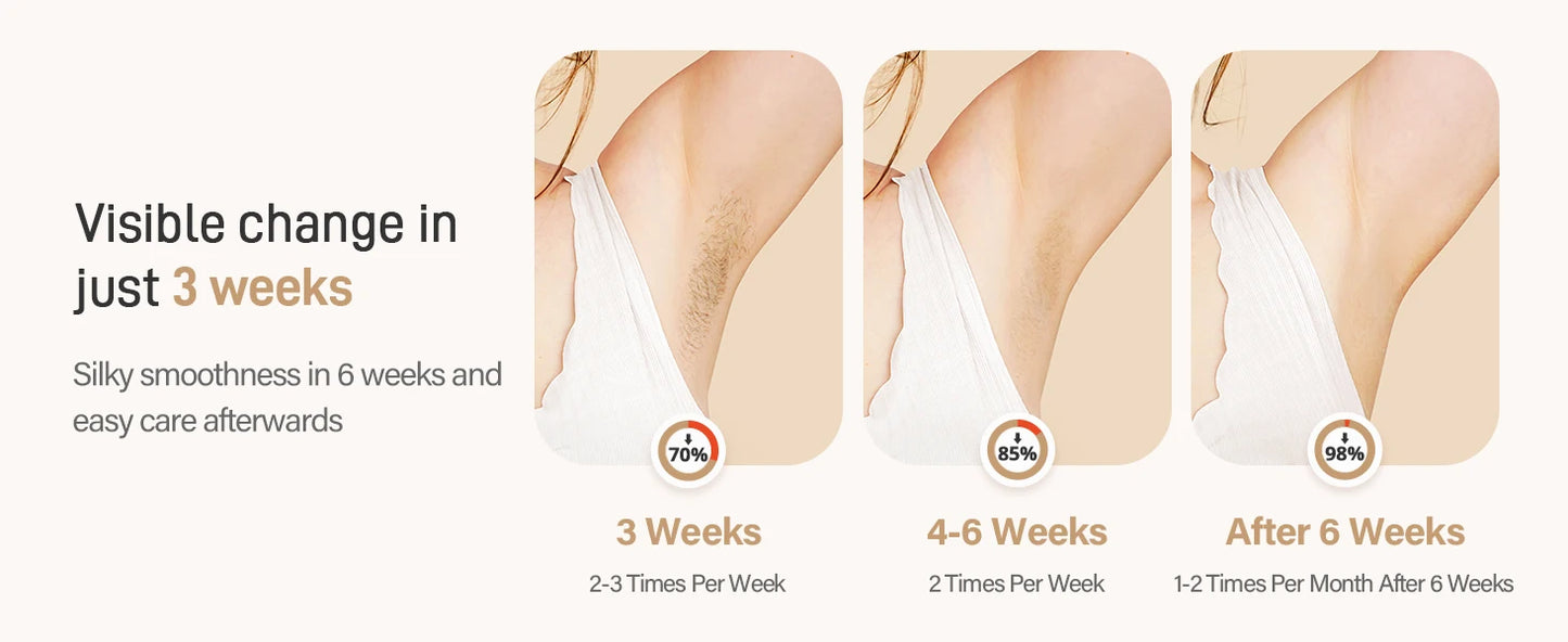 Laser Hair Removal 0.1S/flash 999900+ 22J IPL Hair Remover 3 Modes Body Face Bikini Home Treament Laser Epilator for Women Men
