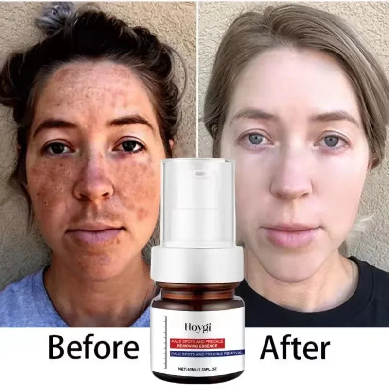 Collagen Face Serum Cream Set Anti-Aging Firming Lifting Fine Line Deep Anti Sagging Wrinkle Brighten Beauty Skin Care Products