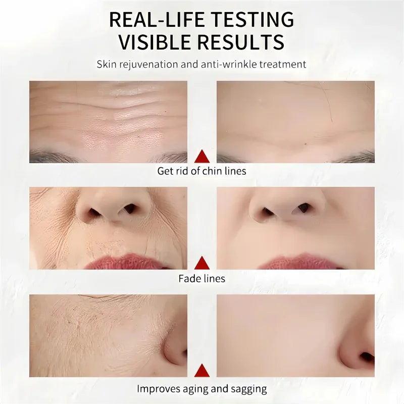 Collagen Face Serum Cream Set Anti-Aging Firming Lifting Fine Line Deep Anti Sagging Wrinkle Brighten Beauty Skin Care Products