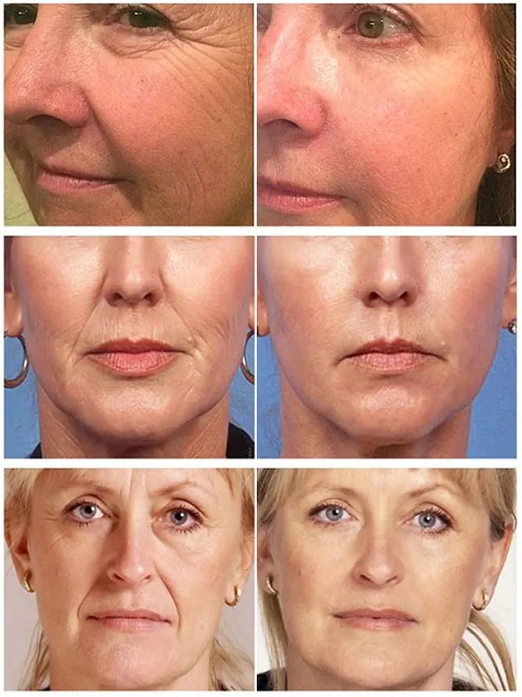 Collagen Face Serum Cream Set Anti-Aging Firming Lifting Fine Line Deep Anti Sagging Wrinkle Brighten Beauty Skin Care Products