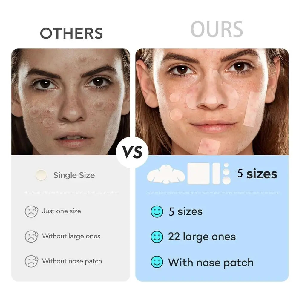 2 Sizes Invisible Professional Healing Absorbing Spot Sticker Covering for Men Women 1set Face Skin Care Acne Pimple Patch