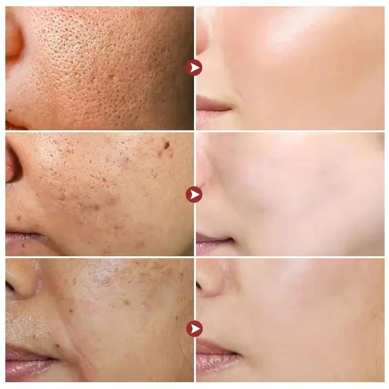 White Rice Whitening Serum Wrinkle Remover Fade Fine Lines Remove Dark Spots Melanin Anti-aging Brighten Smooth Face Skin Care
