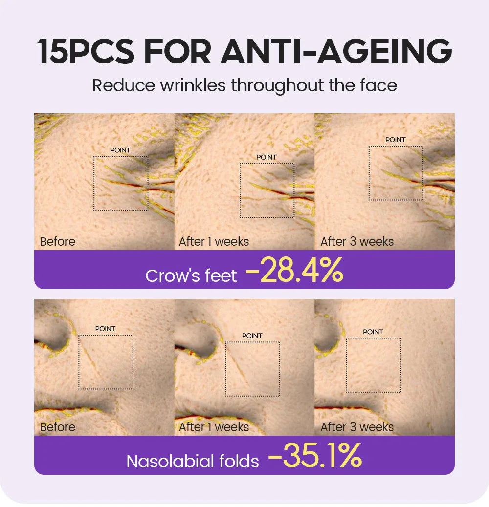 Retinol + Pro-xylane Ampoule serum  Repairs Strengthens The Skin And Diminishes Fine Lines Face Beauty Skin Care 15pcs