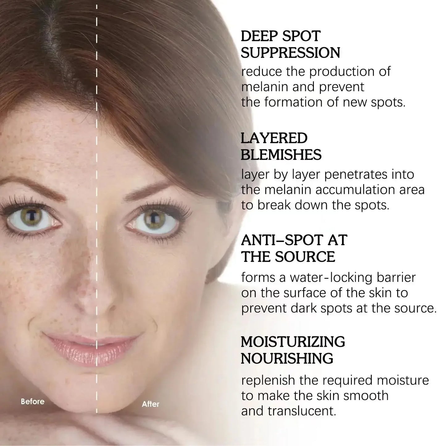 Powerful Dark Spots Remover Freckle Whitening Serum Melanin Correcting Anti Pigmentation Brighten Korean Day Night Facial Care
