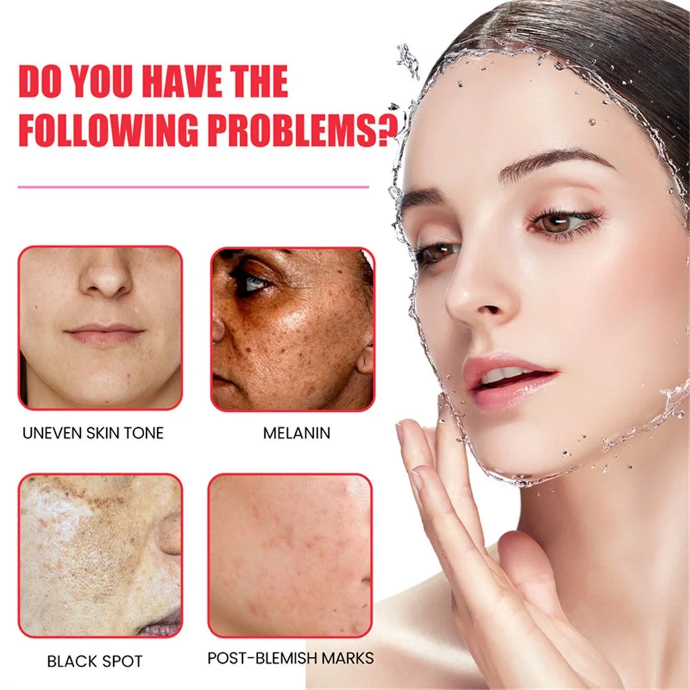 Dark Spots Remover Whitening Serum Face Freckle Melanin Correcting Reduce Fine Lines Brighten Essence Korean Beauty Skin Care