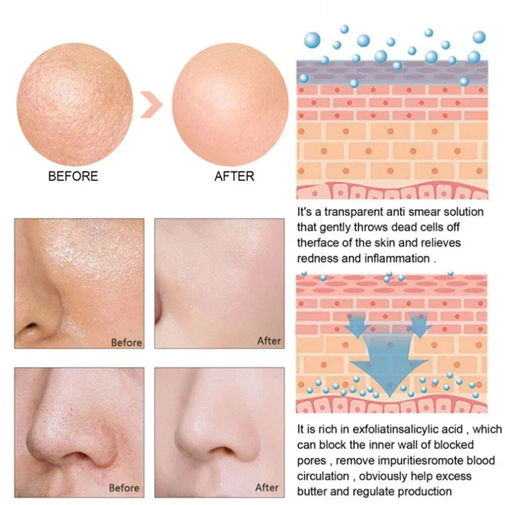 Pore Shrink Face Serum Remove Blackheads Acne Acidity Oil Control Repair Essence Moisturizing Nourish Pores Firming Facial Care